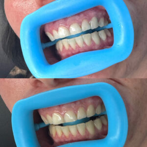 4481da26 b63c 45ea 89a5 9d41c64755d4