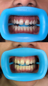 45e3bc1c f827 44ce b4ca 20fd1b5fcd27