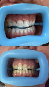 peachy 20250808151138117