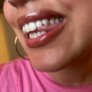 IMG_0423